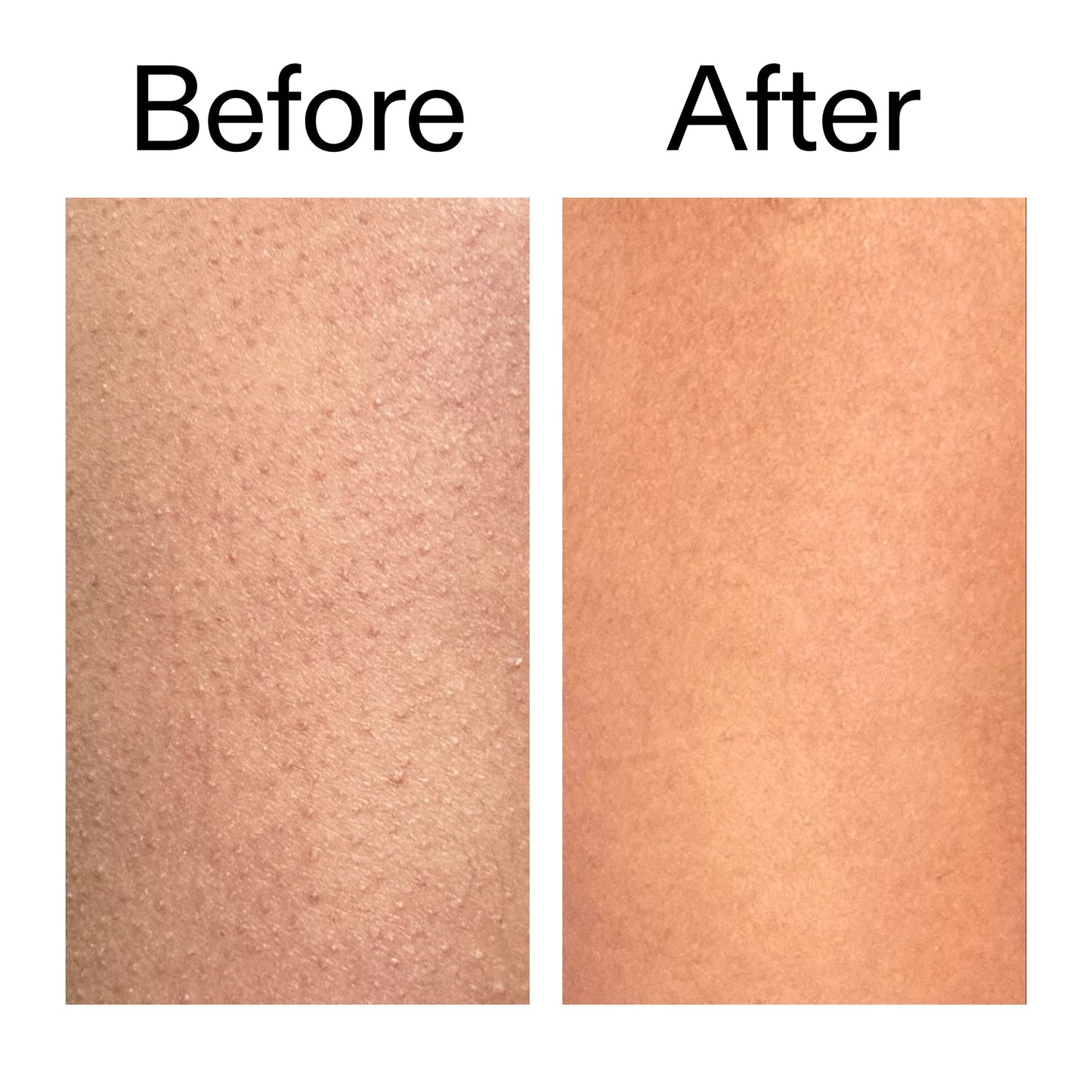 glycolic-acid-exfoliating-body-stick-a6 Glycolic_Body_Stick_B_A_2000x2000_6e6e6b4d-5bd7-43c0-aeed-4d66788e8995.jpg