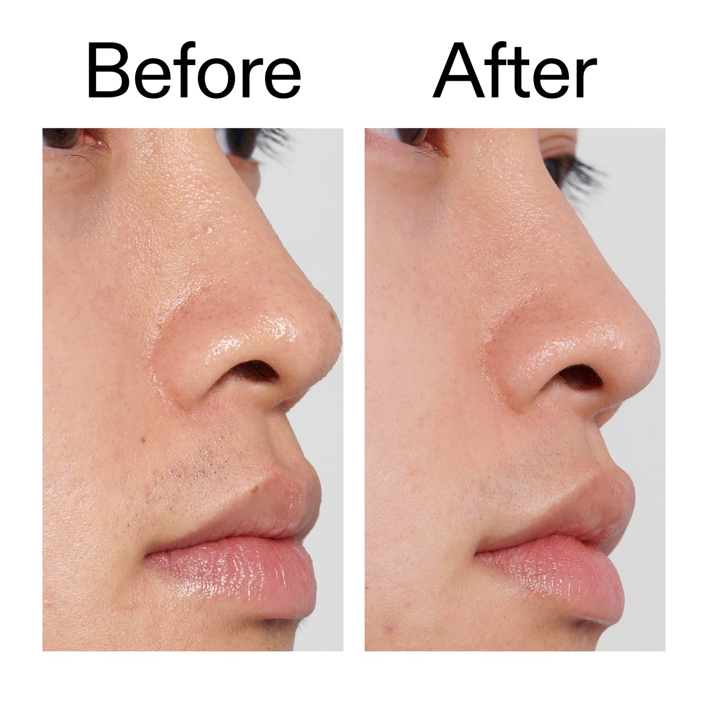 pha-toner-s5 PHA_Toner_Before_After_2000x2000_e3c10172-0150-4342-8b95-57417eaff50d.jpg