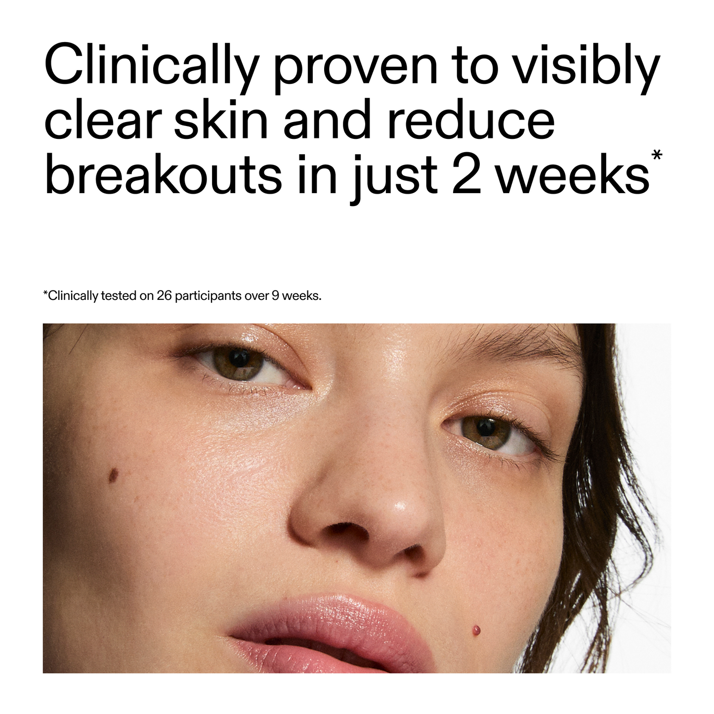 360-acne-clearing-serum-i9 360_Serum_Key_Claim.png