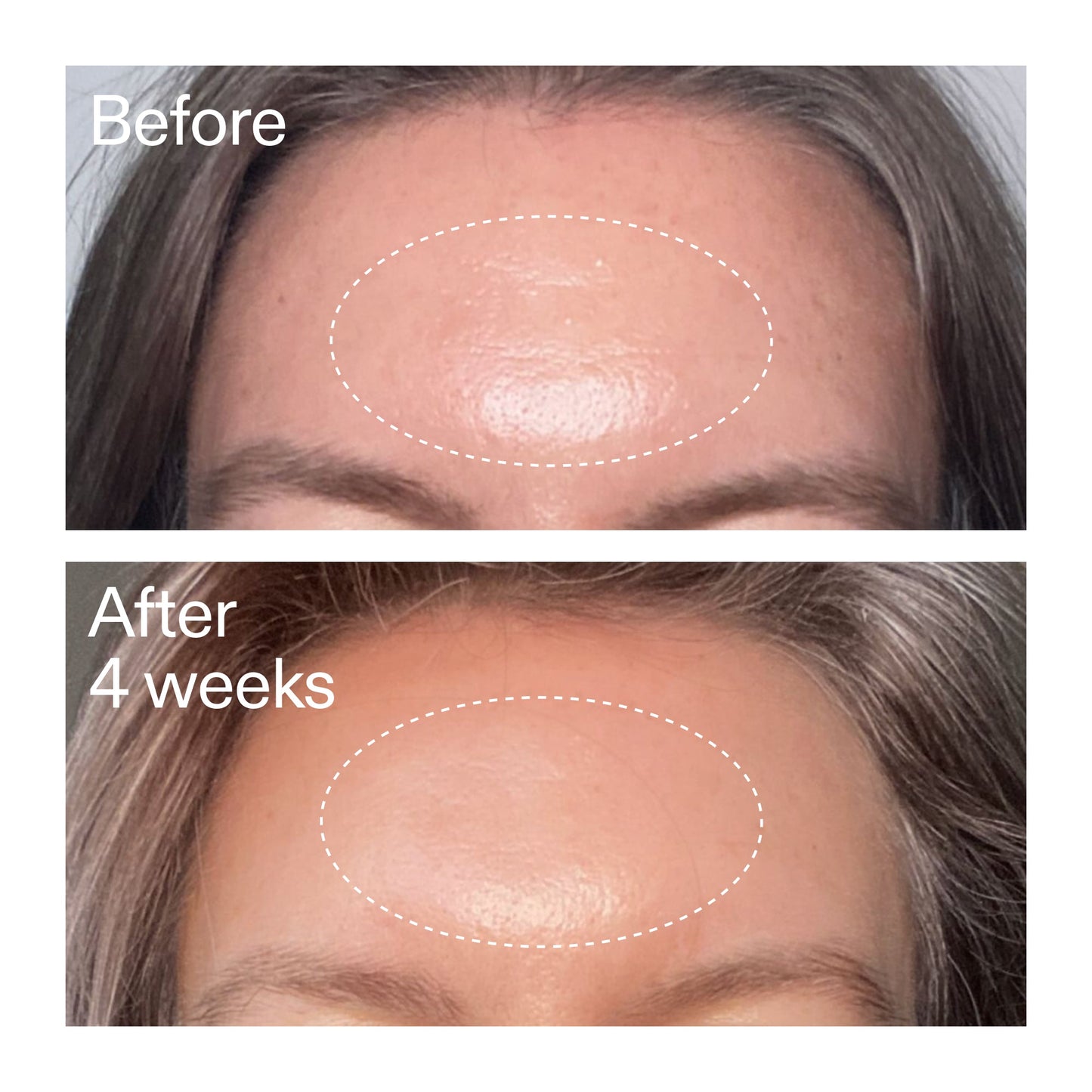 advanced-0-2-retinal-serum-duo-t9 AdvancedRetinal_BeforeAfter1_2000x2000_4e9c798a-f30e-45b8-a34a-7c4740f2f2cb.jpg