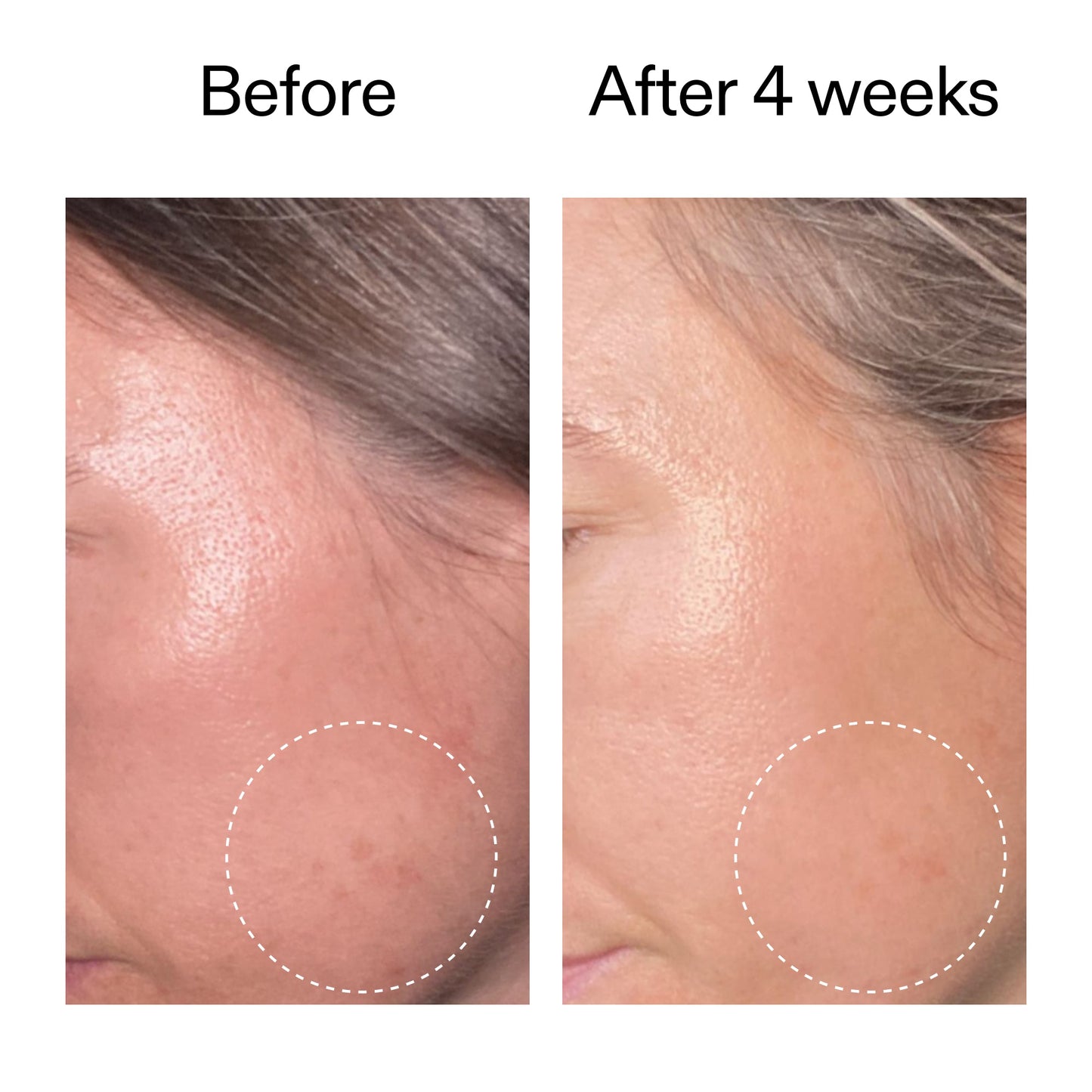 advanced-0-2-retinal-serum-w0 AdvancedRetinal_BeforeAfter2__2000x2000_62fb16bb-77ae-4d63-8500-88dbf847f4b9.jpg