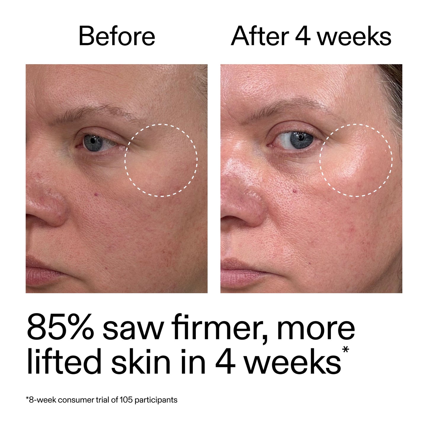 advanced-0-2-retinal-serum-w0 AdvancedRetinal_BeforeAfter_Claim1_2000x2000_bcc385c4-5e73-4f1e-aba8-64267937d0d3.jpg