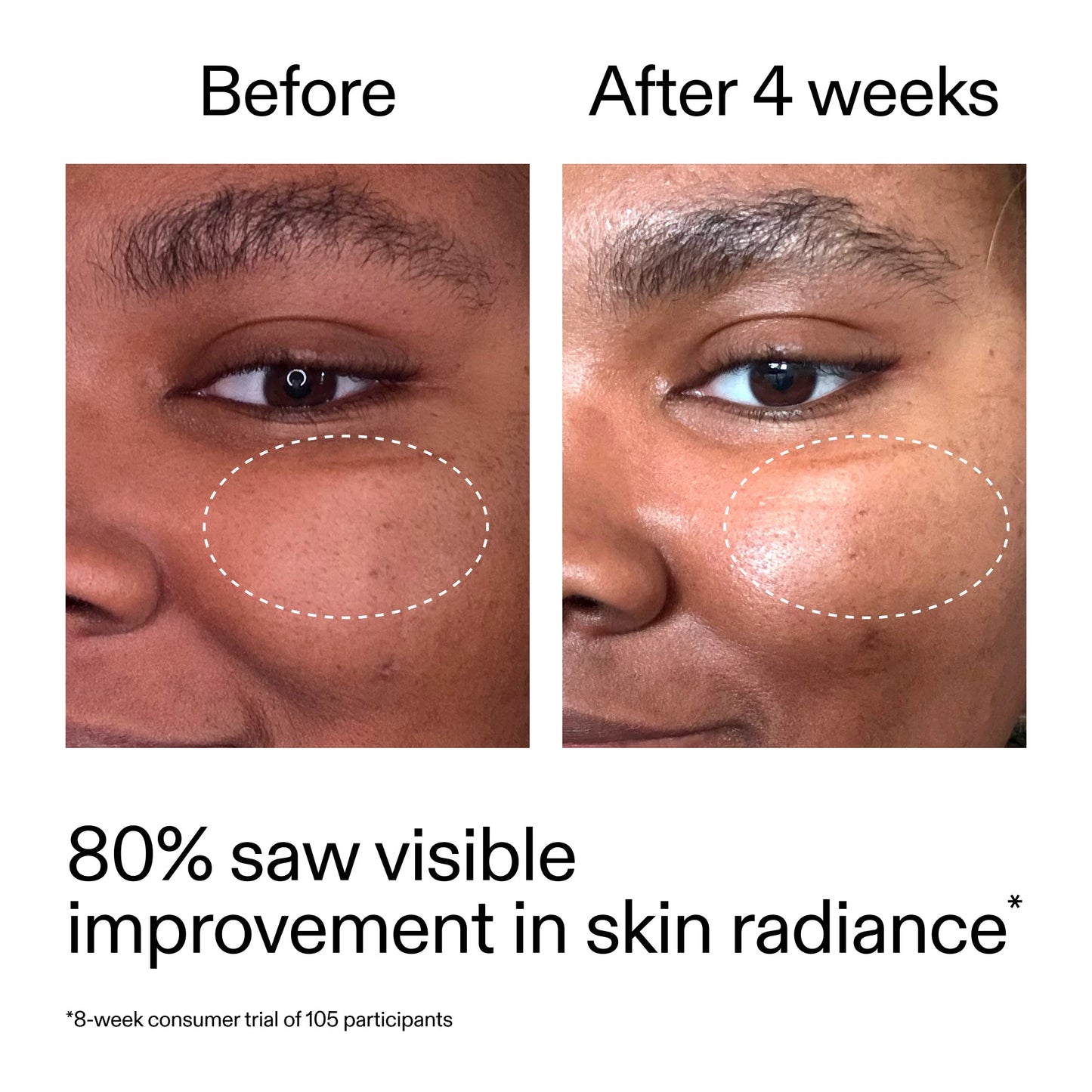 advanced-0-2-retinal-serum-w0 AdvancedRetinal_BeforeAfter_Claim2_2000x2000_39d11e3d-eda9-44ec-ab32-2903b1a368bd.jpg