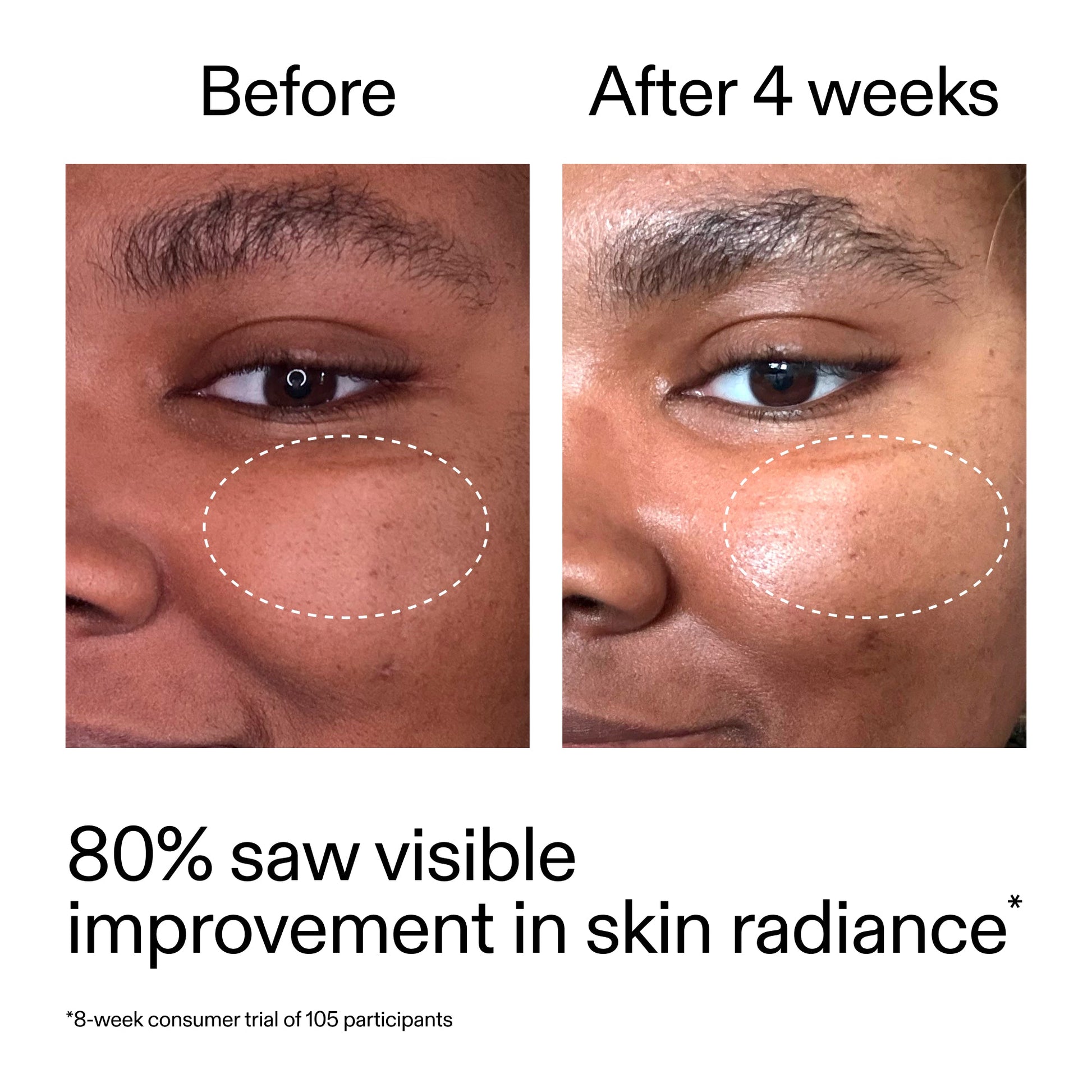 advanced-0-2-retinal-serum-duo-t9 AdvancedRetinal_BeforeAfter_Claim2_2000x2000_681b621d-8d44-4d44-9a40-89244f9b2e53.jpg