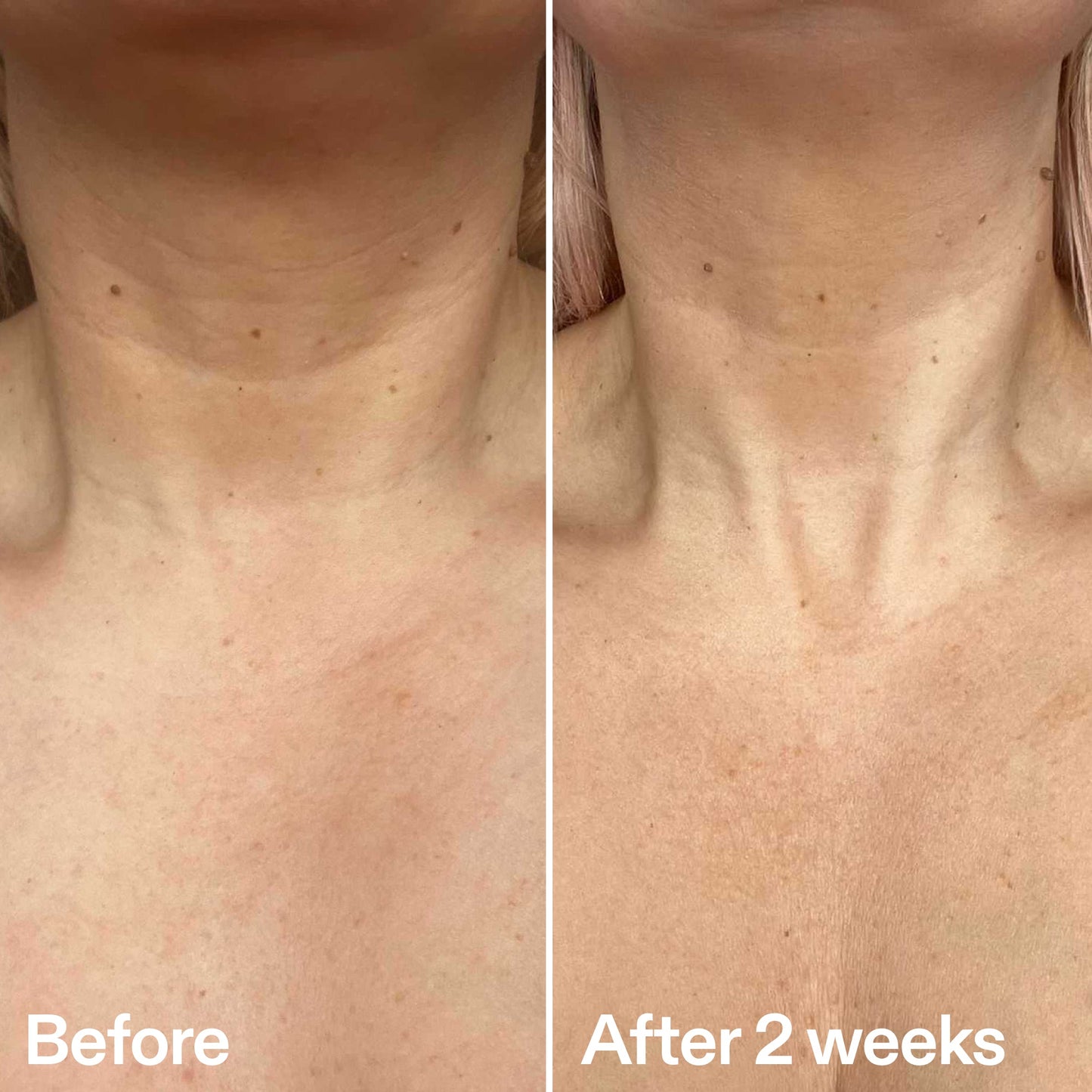 bio-active-neck-lift-stick-t4 B_A_2.jpg