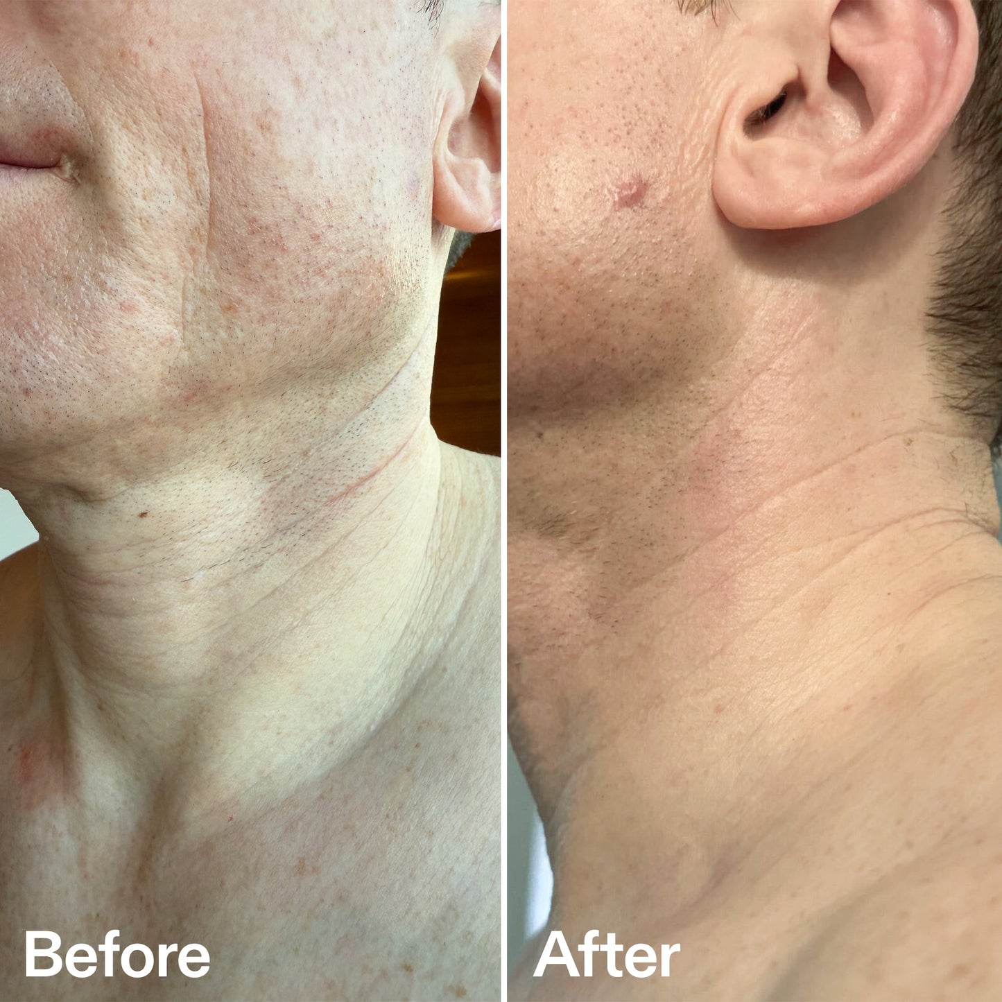 bio-active-neck-lift-stick-t4 B_A_afa2743e-b8e2-4504-92f4-e281cb6cf759.jpg