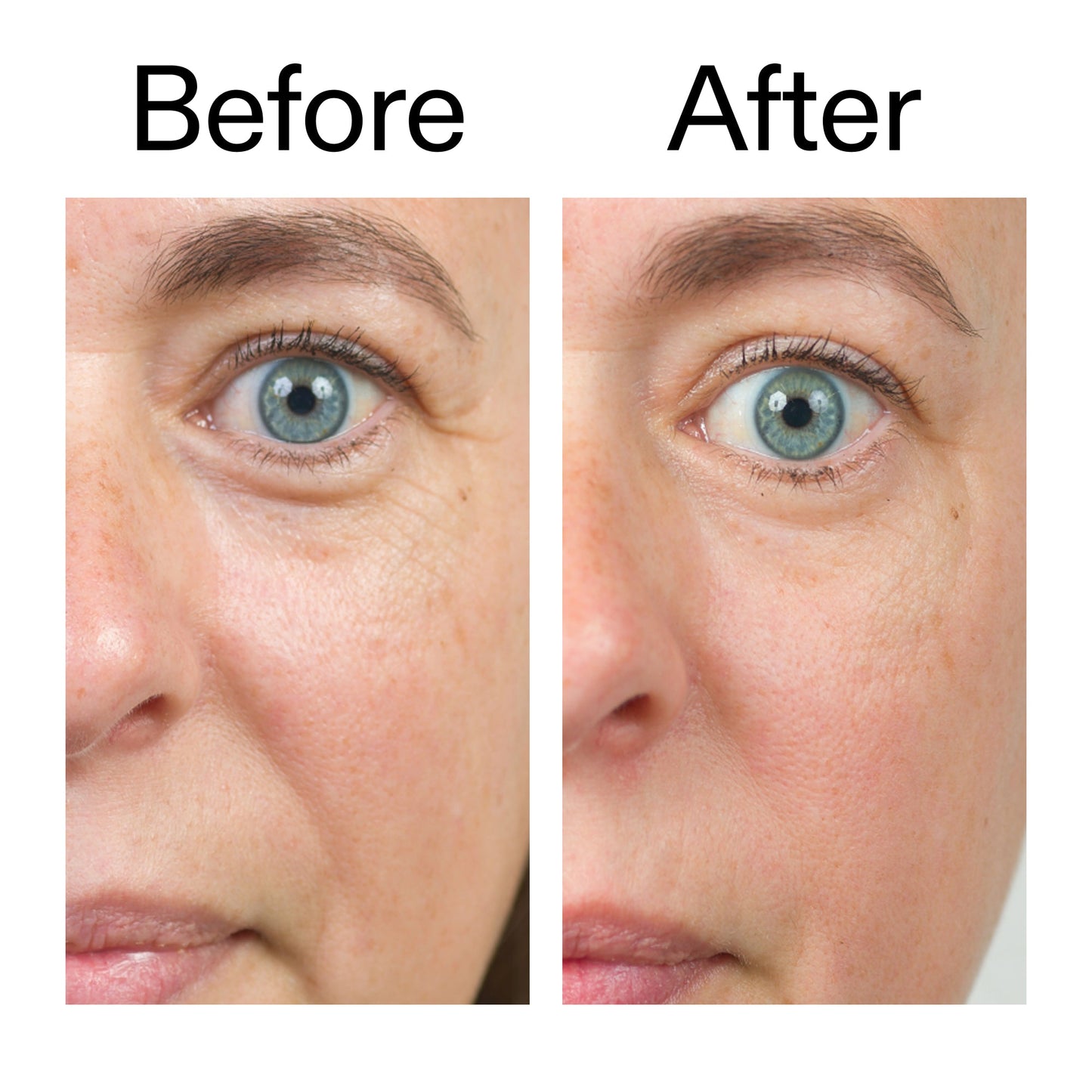 bio-active-ceramide-moisturizer-b0 Bio-Active_Before_After_2000x2000_566e5a9e-135e-417a-8242-b44e5fa35463.jpg