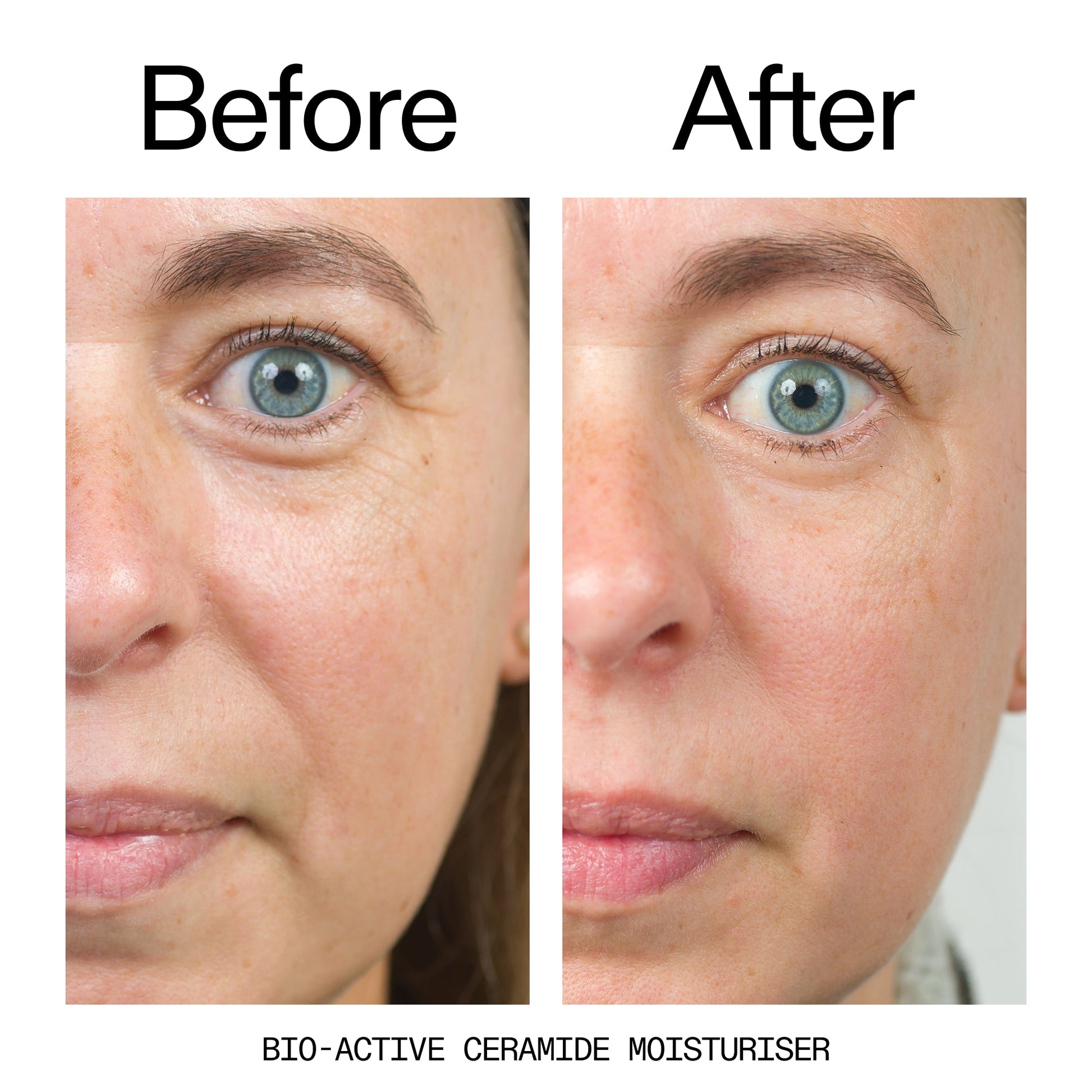 barrier-boosting-trio-x1 Bio-Active_Before_After_2000x2000_600947b4-e8c5-425a-9155-fc15bc83aa12.jpg