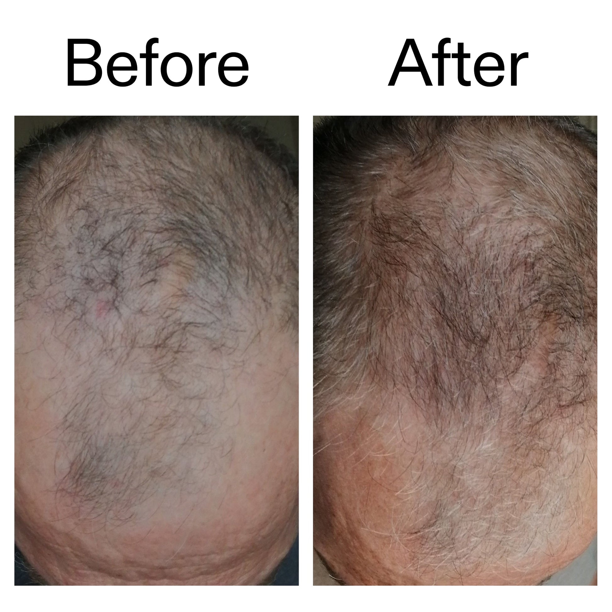 caffeine-stimulating-scalp-treatment-o3 Caffeine_Scalp_Treatment_B_A_Ppage_2000_x_2000.jpg