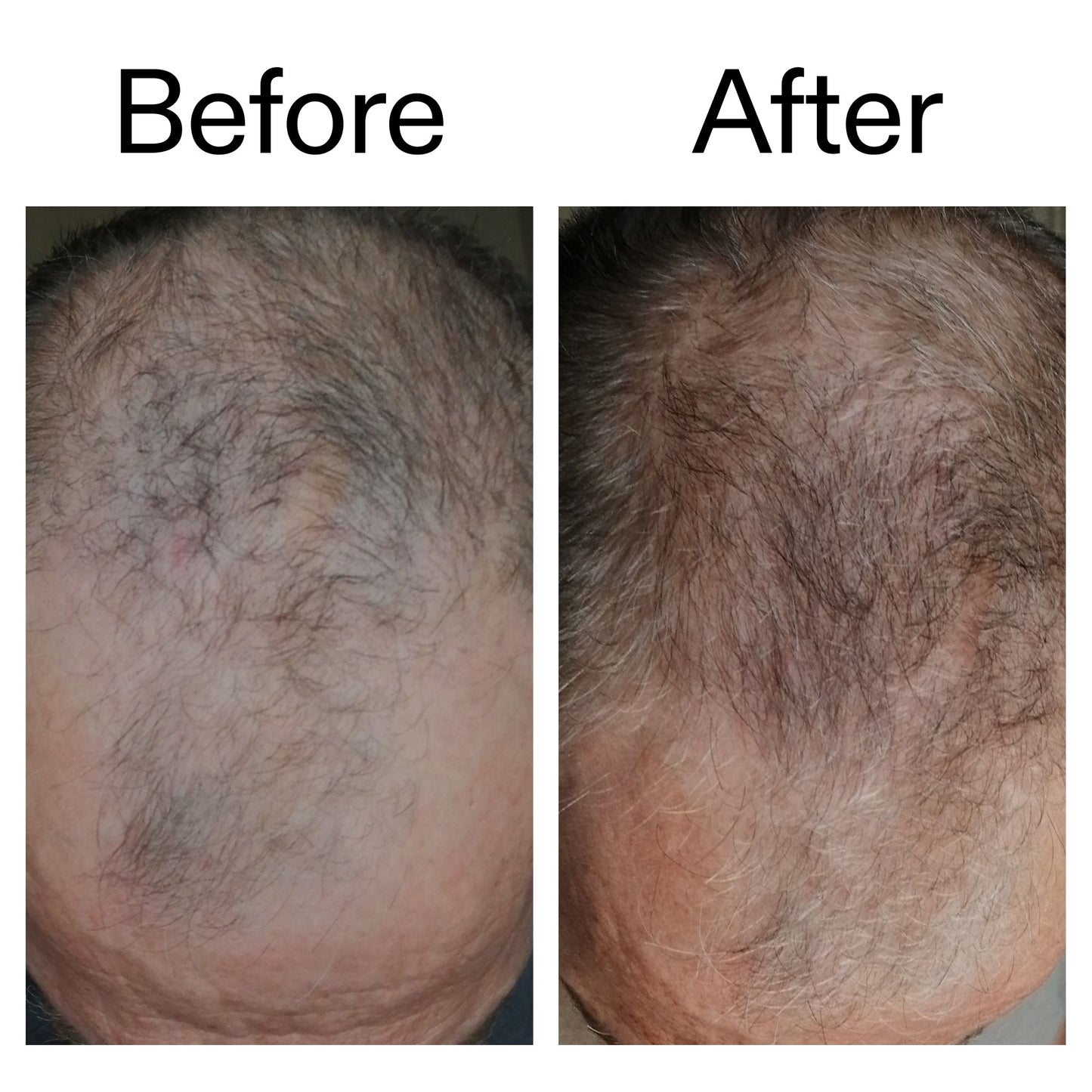 3-month-hair-growth-trio-a4 Caffeine_Scalp_Treatment_B_A_Ppage_2000_x_2000.jpg