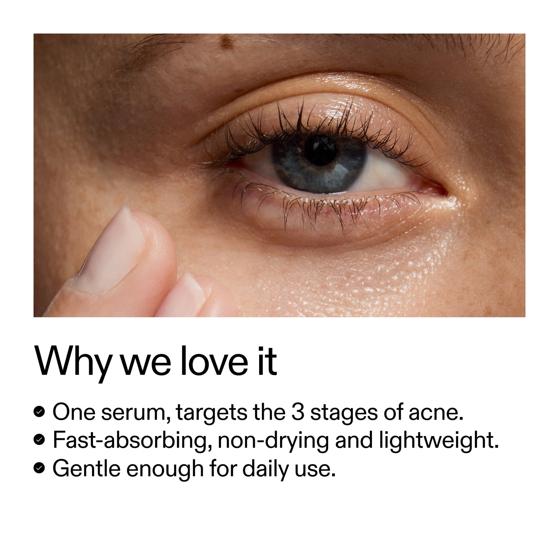 360-acne-clearing-duo-t3 Dioic_Whyweloveit_2000x2000_175aafd3-0cbe-403a-b317-a8362881bfe2.jpg