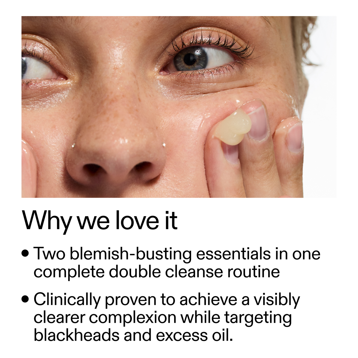acne-double-cleanse-duo-g2 Double_Cleanse_Duo_for_Breakouts_Why_We_2000x2000_f242cb12-bb5c-487c-b203-071ccb406ec5.png