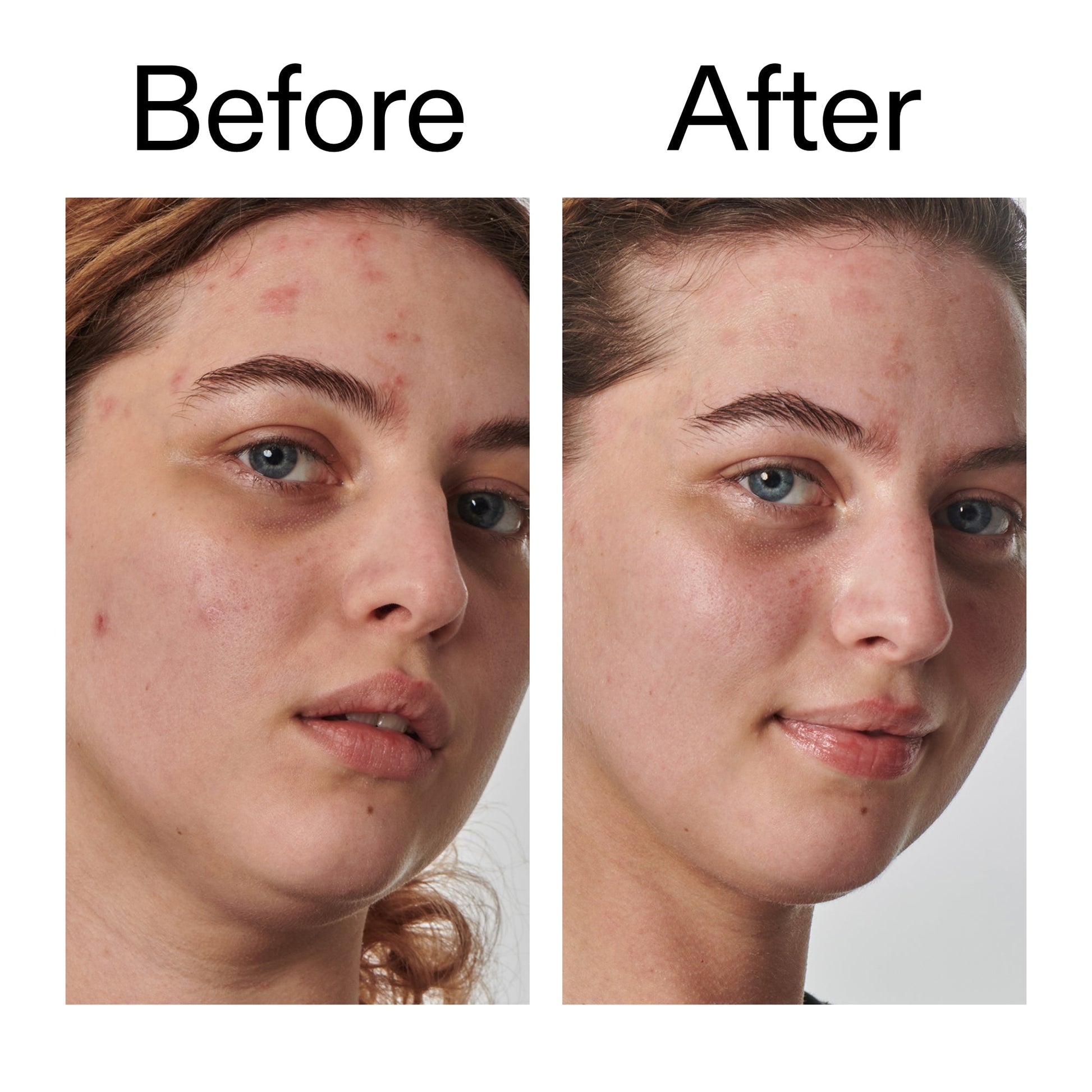 10-urea-moisturizer-m4 Dry_and_Rough_Skin_Solution_Before_After_2000x2000_efa6e639-5c39-49bd-a5dd-f0220293120a.jpg