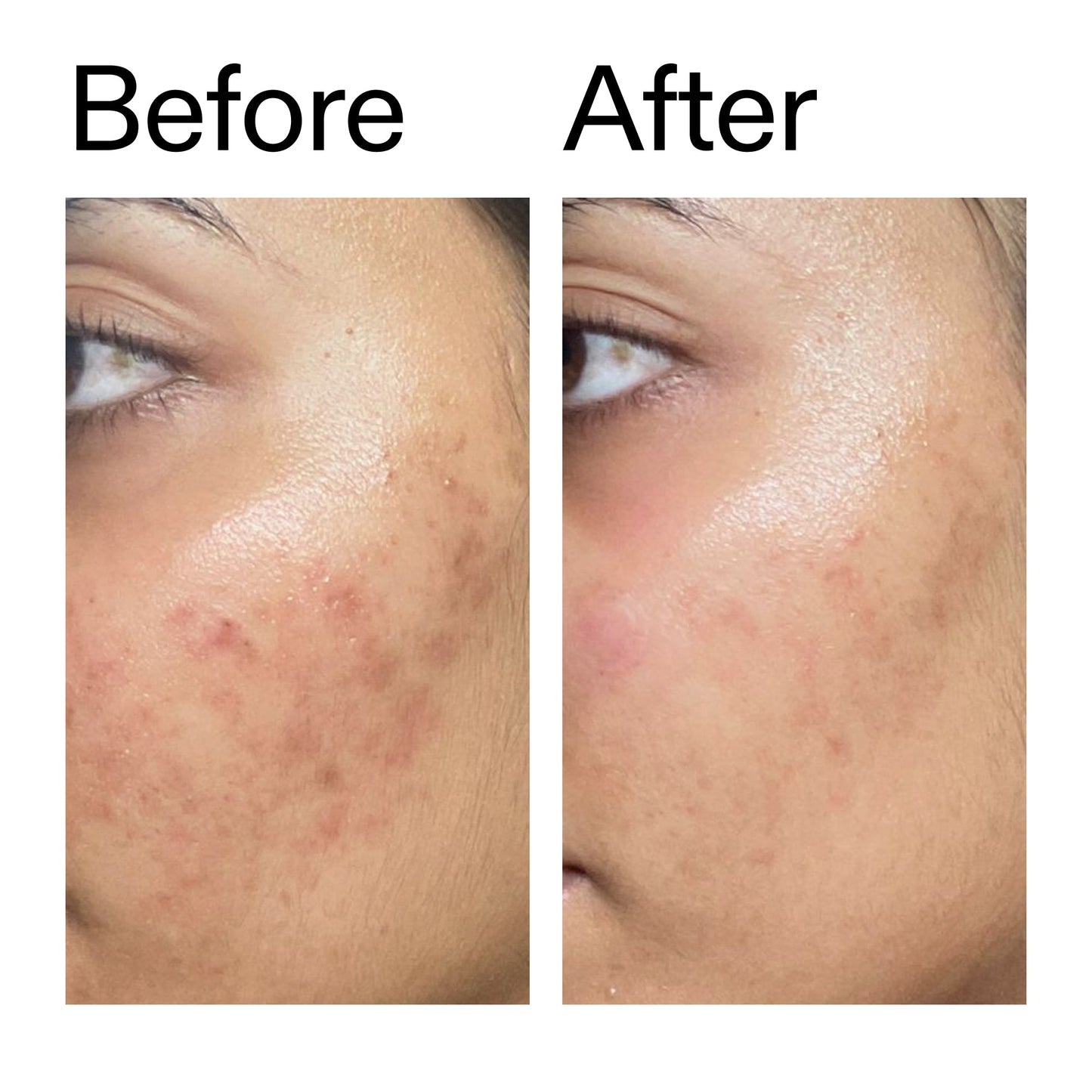 ectoin-hydro-barrier-serum-duo-w2 Ectoin_Hydro-barrier_Serum__Before_After_2000x2000_34261920-d004-48d0-9c7b-8e1c15971bfd.jpg