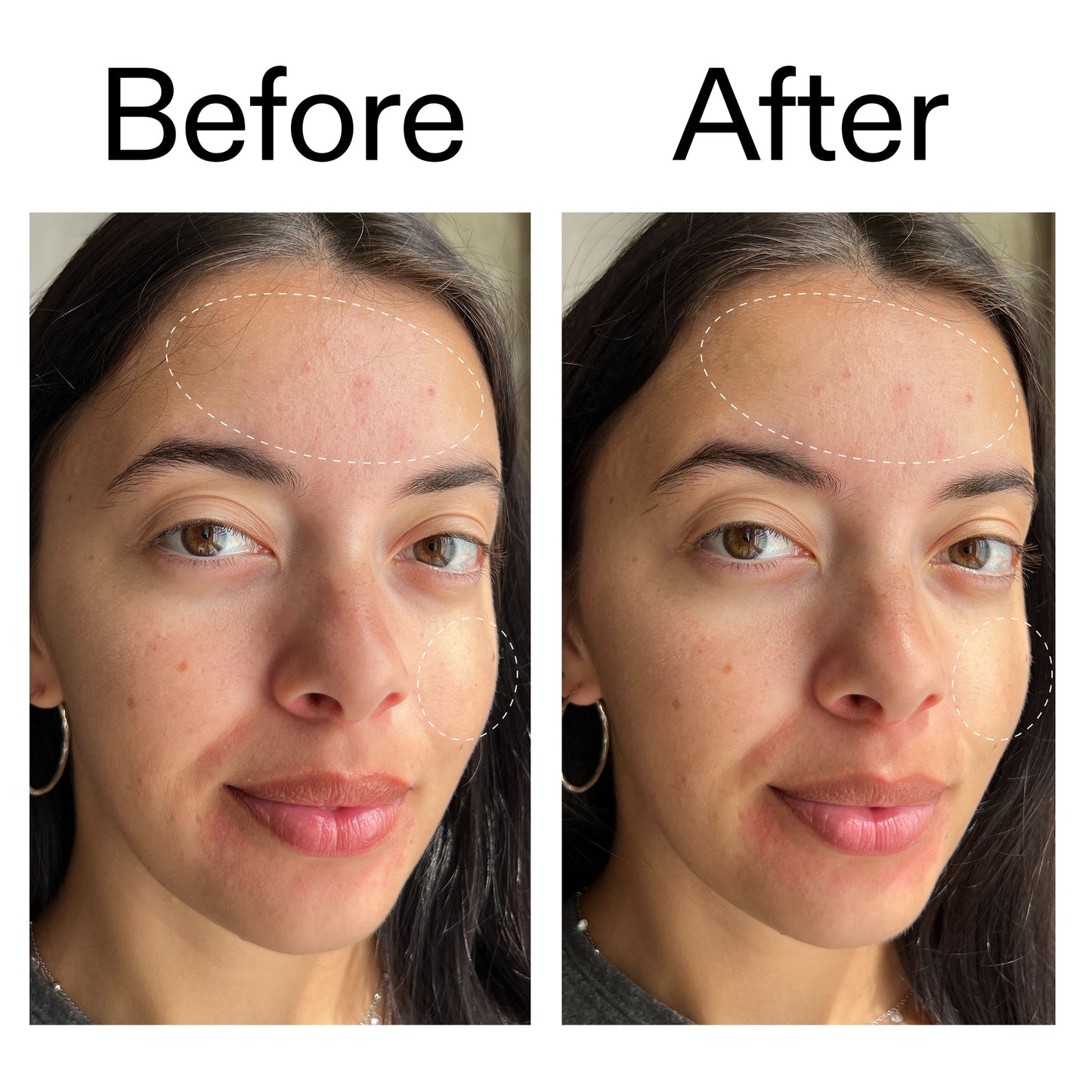 glycerin-gentle-purifying-cleanser-g4 Glycerin_B_A_2000x2000_19037705-c220-4333-99c1-e648cc3ac1d7.jpg