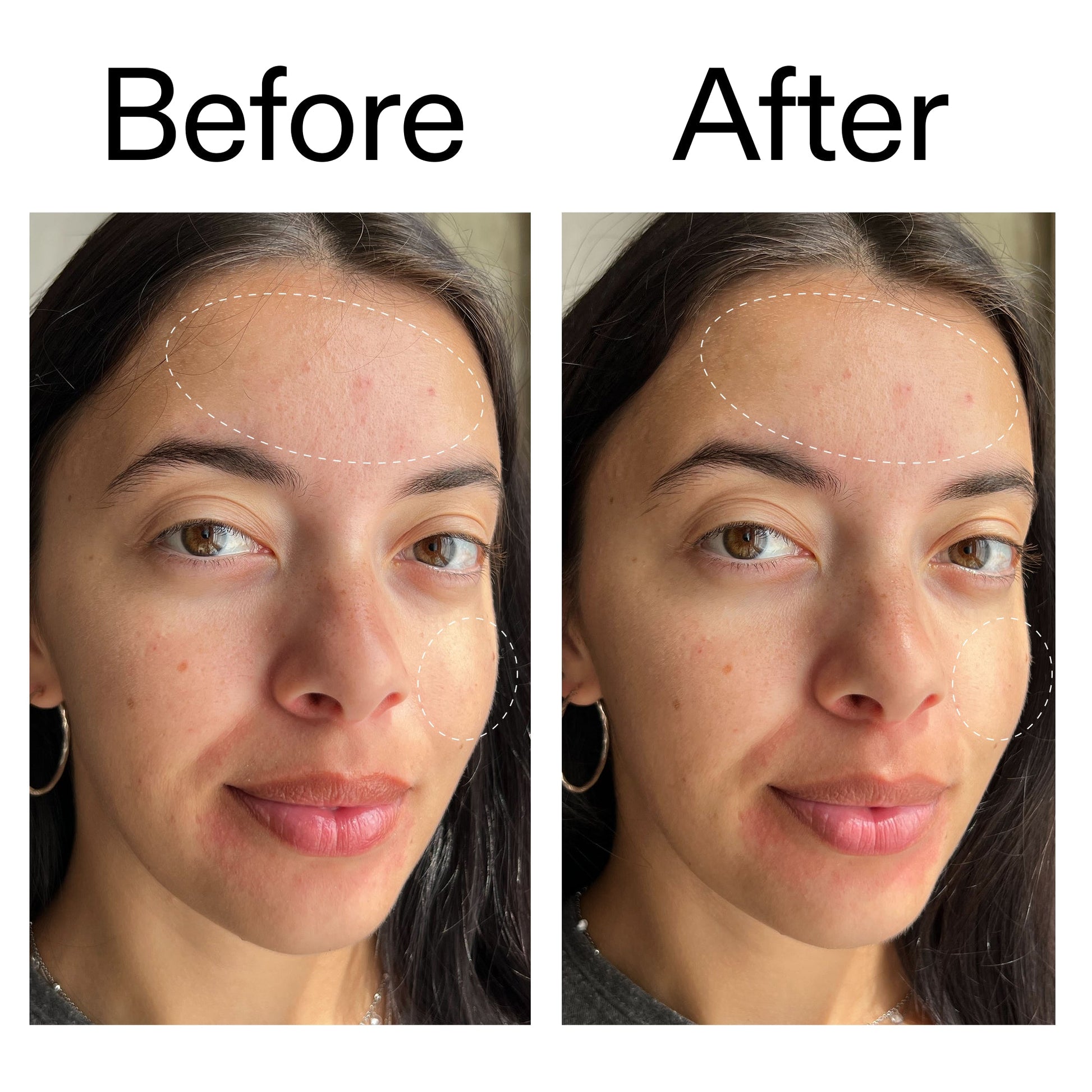 glycerin-gentle-purifying-cleanser-g4 Glycerin_B_A_2000x2000_19037705-c220-4333-99c1-e648cc3ac1d7.jpg