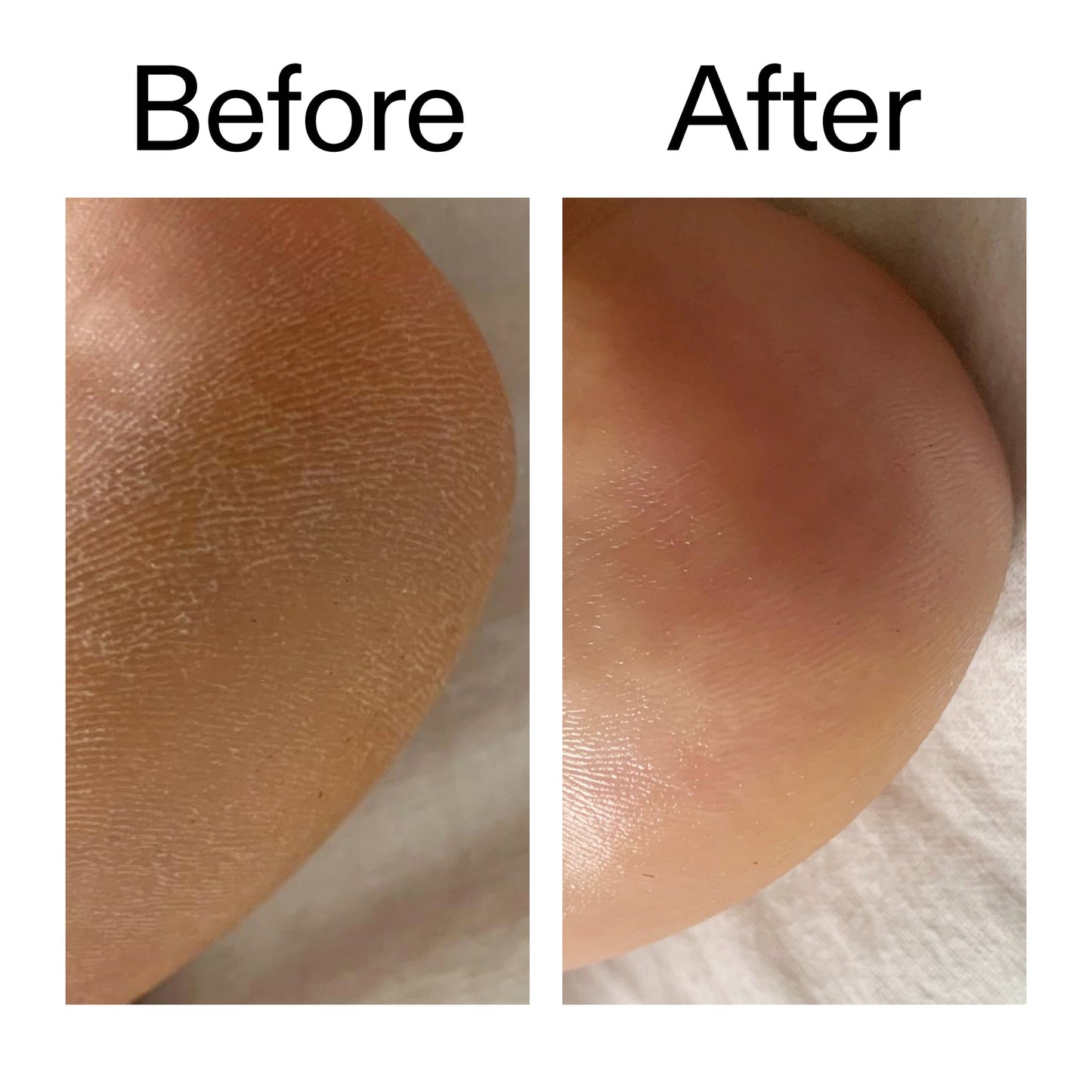 glycolic-acid-exfoliating-body-stick-a6 Glycolic_Acid_Exfoliating_Body_Stick_Before_After_V1_2000x2000_a3043625-9400-429a-a7fb-d6dbd220f722.jpg
