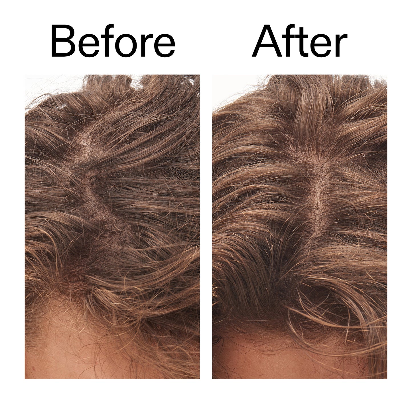 glycolic-acid-exfoliating-scalp-scrub-o8 Glycolic_Acid_Exfoliating_Scalp_Scrub_Before_After_2000x2000_b8561c87-05a1-4caa-80f7-1b6b33d750f7.jpg