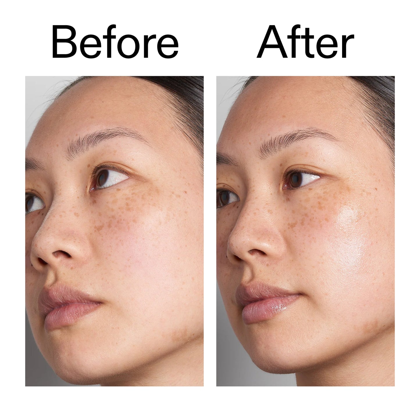 hyaluronic-acid-serum-60ml-duo-w5 Hyaluronic_Acid_Before_After_2000x2000_d566f5ba-a77e-4585-99fd-0f4682b164dd.jpg
