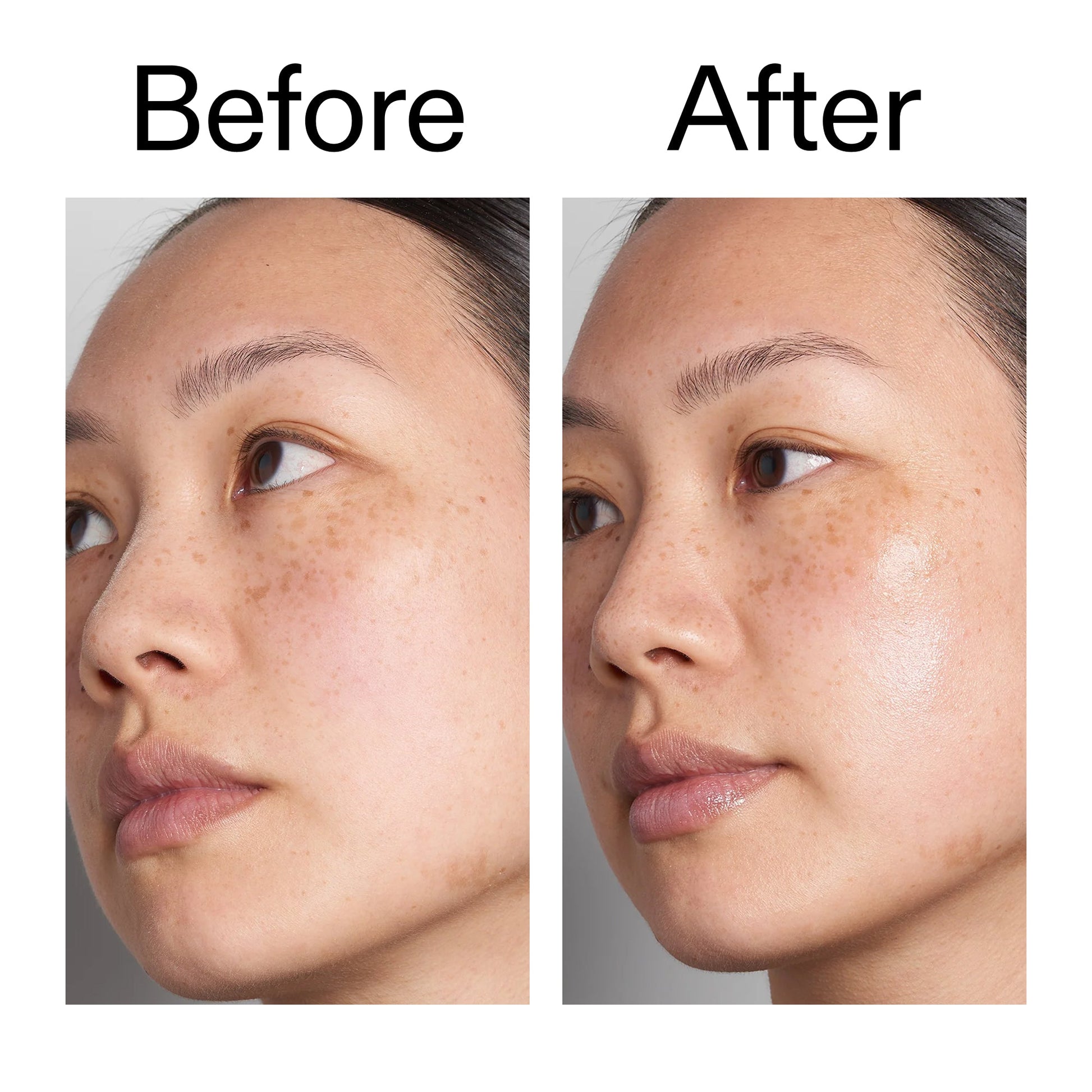 supersize-hyaluronic-acid-serum-100ml-duo-z8 Hyaluronic_Acid_Before_After_2000x2000_d7983956-8aa2-4ea3-8255-c63e8d4f892e.jpg