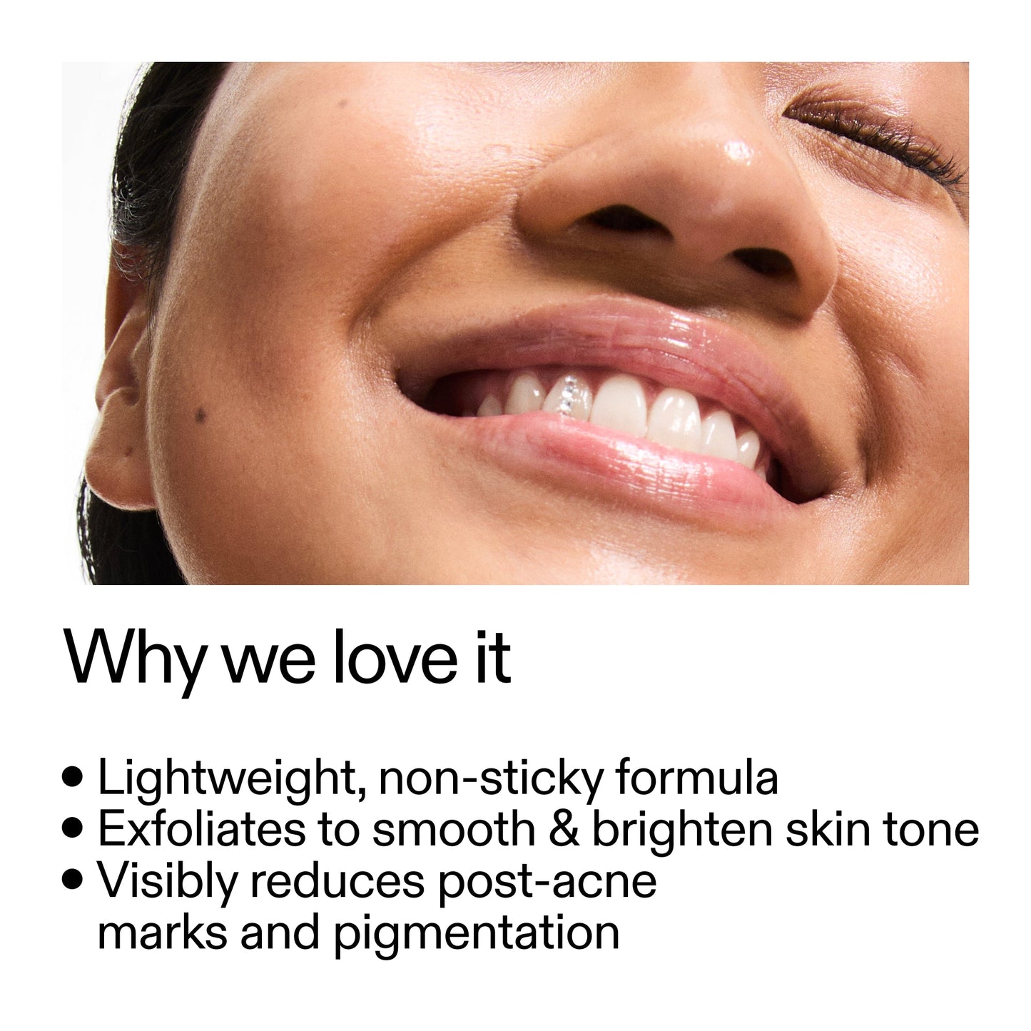 mandelic-acid-treatment-o5 Mandelic_Acid_Treatment_Why_we_love_it_2000x2000_6dfe29a9-2a79-464f-a5e8-e5ac37d93388.jpg