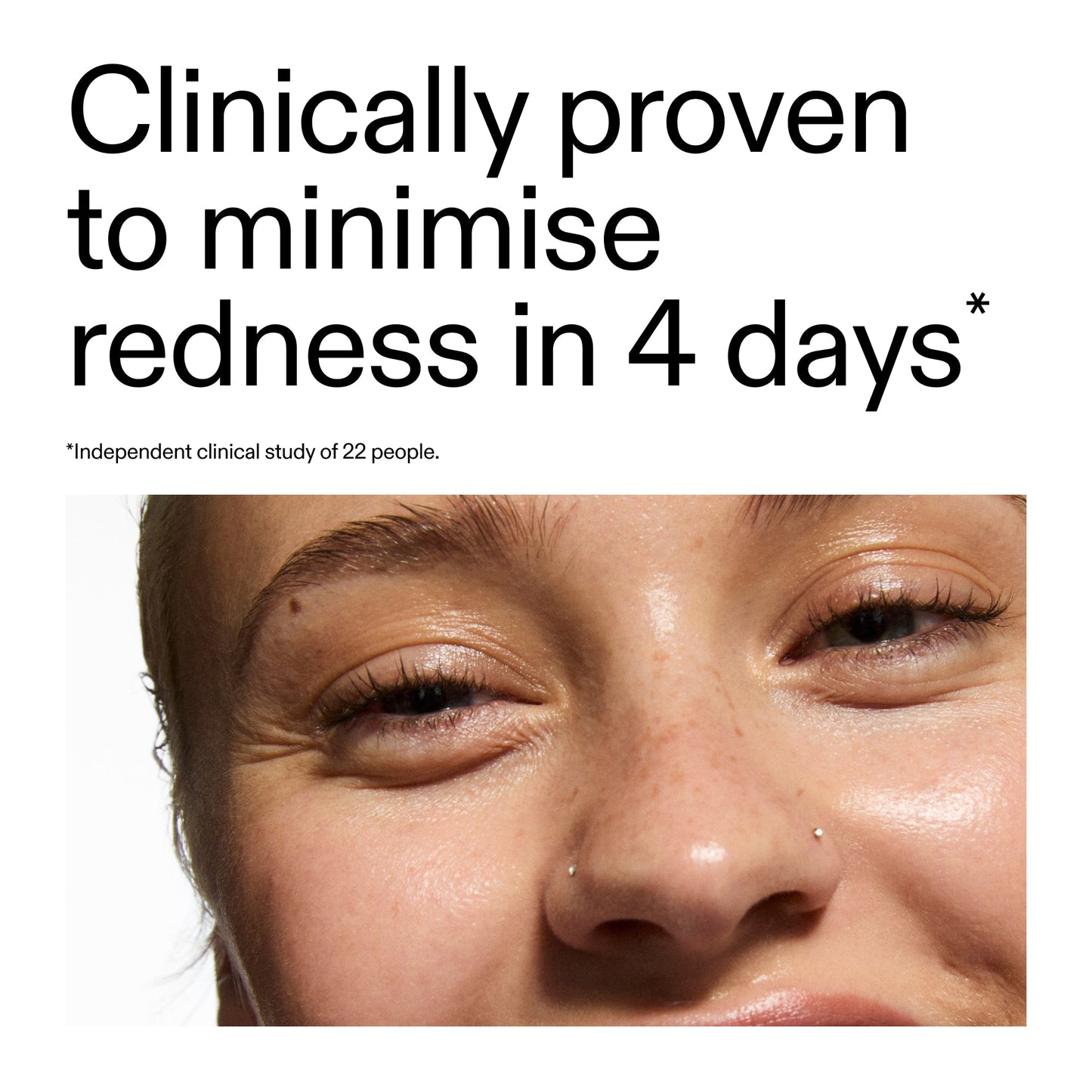 10-azelaic-acid-serum-for-redness-relief-k0 Oat_Cleansing_Balm_Claim_2000x2000_52a841dc-353c-4f2c-8646-3aadb604507d.jpg