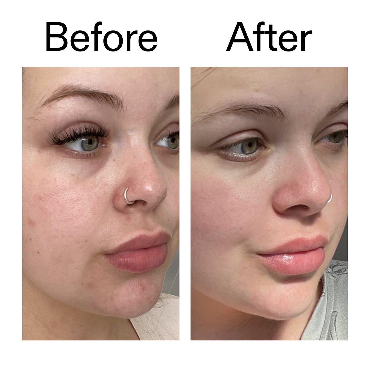 omega-water-cream-50ml-z7 Omega50_Before_After_2000x2000_46483ed8-3f9d-487f-9a0c-9df79830bd65.jpg