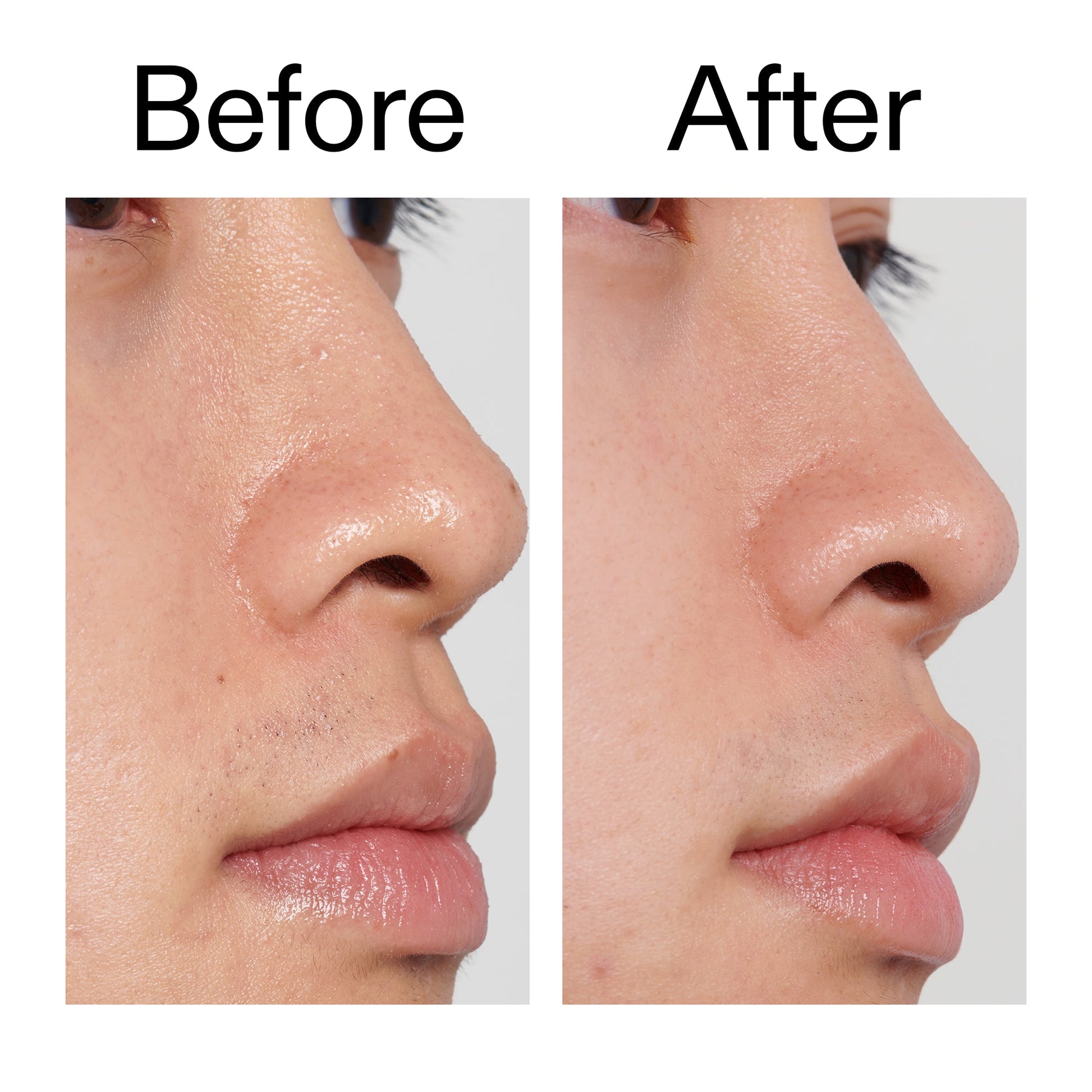 pha-toner-s5 PHA_Toner_Before_After_2000x2000_e3c10172-0150-4342-8b95-57417eaff50d.jpg