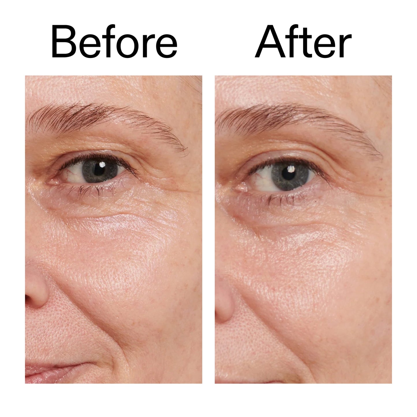 retinol-eye-cream-u6 Retinol_Eye_Cream_Before_After_2000x2000_ac03a80c-109e-4572-a95a-91dc109b4d27.jpg