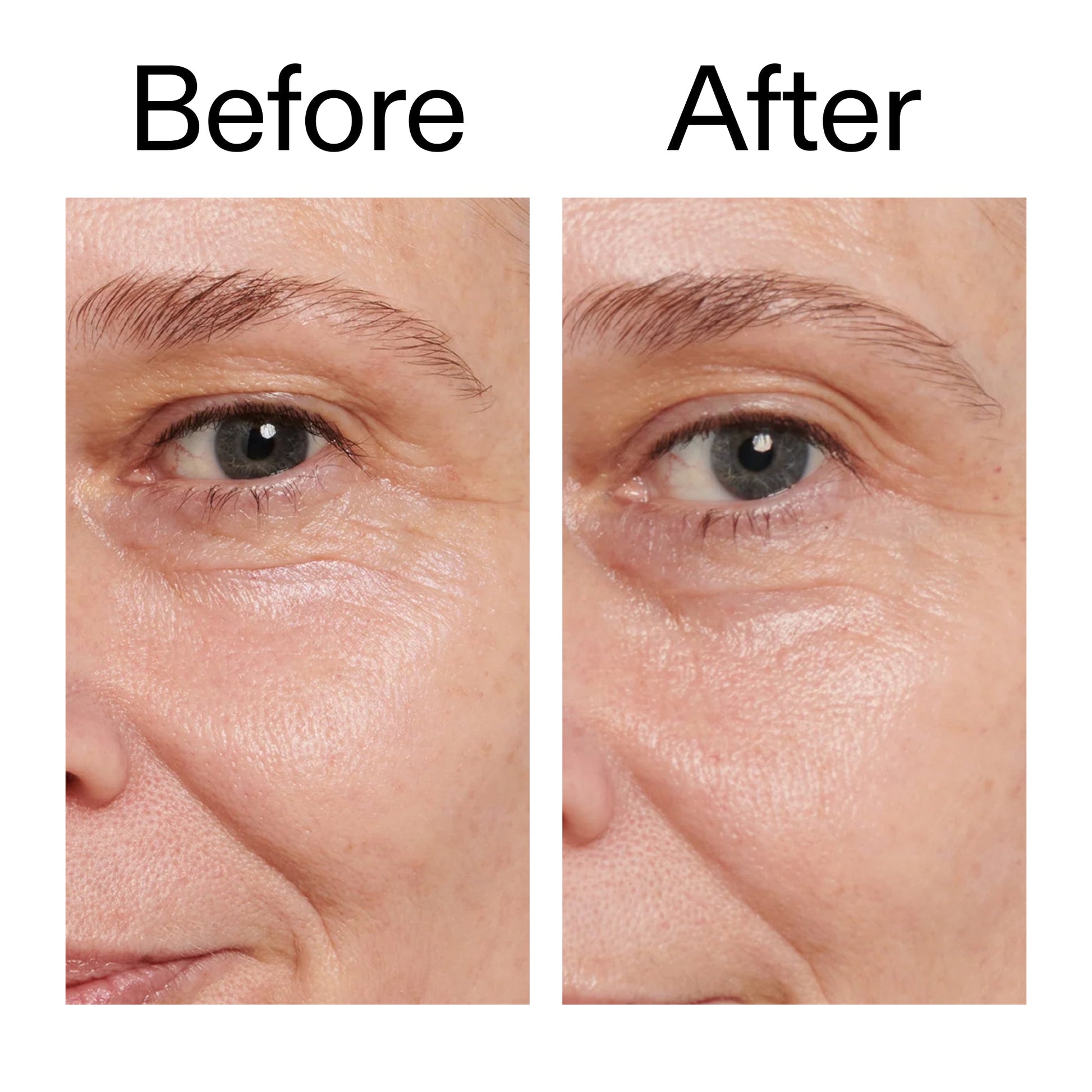 retinol-eye-cream-u6 Retinol_Eye_Cream_Before_After_2000x2000_ac03a80c-109e-4572-a95a-91dc109b4d27.jpg