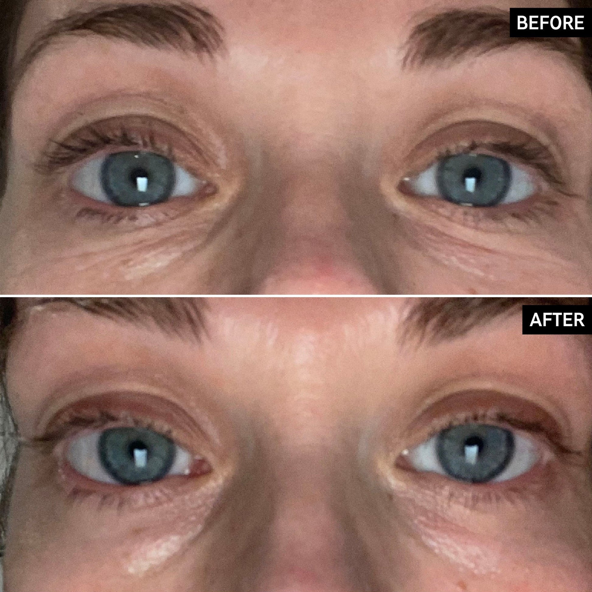 retinol-eye-cream-u6 SITE-UGCBAsApril_Nicole_B_A_PPage_2000x2000_1.jpg