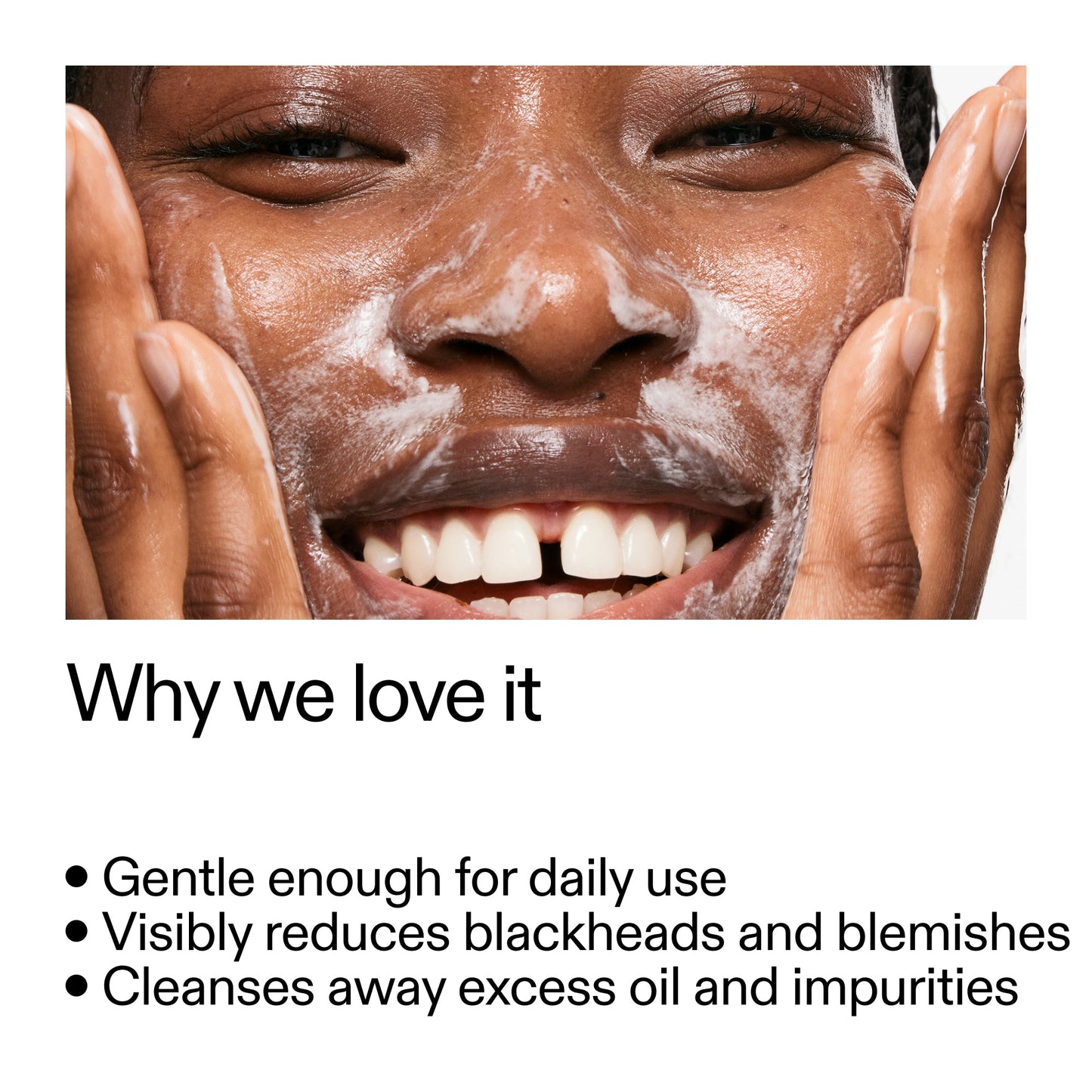 salicylic-acid-cleanser-150ml-t5 Salicylic_Acid_Cleanser_-_300mlWhy_we_love_it_2000x2000_87dc92a9-2559-4309-98cd-4e570f1be735.jpg