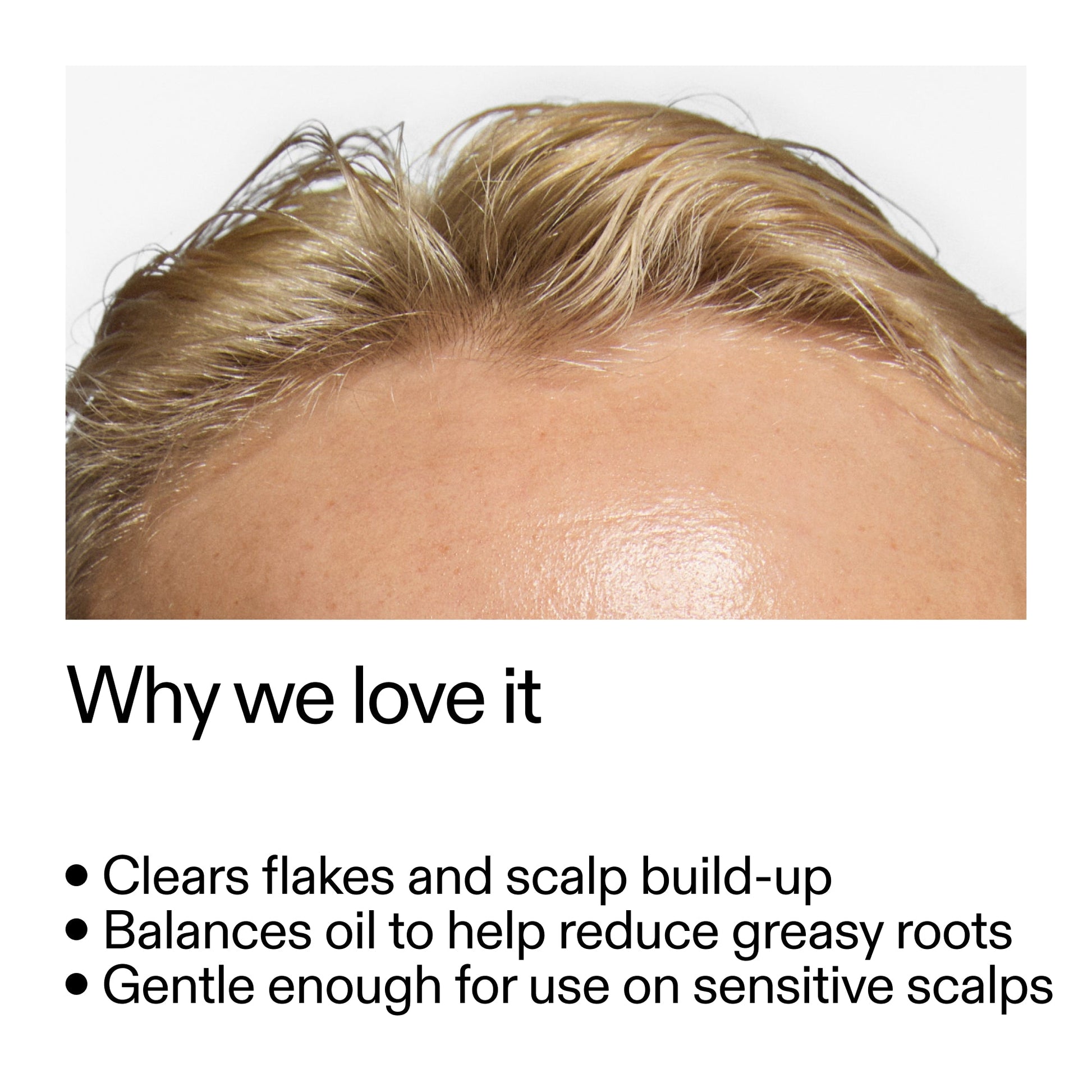 salicylic-acid-exfoliating-scalp-treatment-y3 Salicylic_Acid_Exfoliating_Scalp_Treatment_Why_we_love_it_2000x2000_44b6bd6d-9ec4-4b23-9dc4-bc3fd6f28e14.jpg
