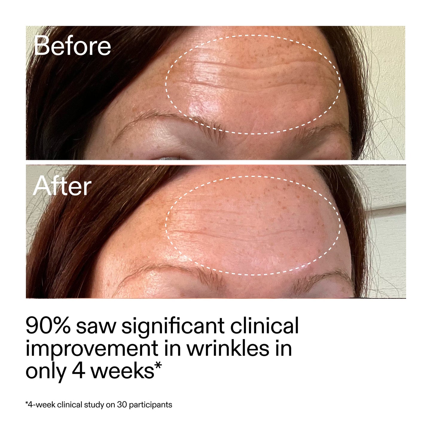 starter-retinol-serum-k9 StarterRetinol_BeforeAfter_Claim1_2000x2000_a09b50b6-4688-4527-abae-21bd142b89b7.jpg