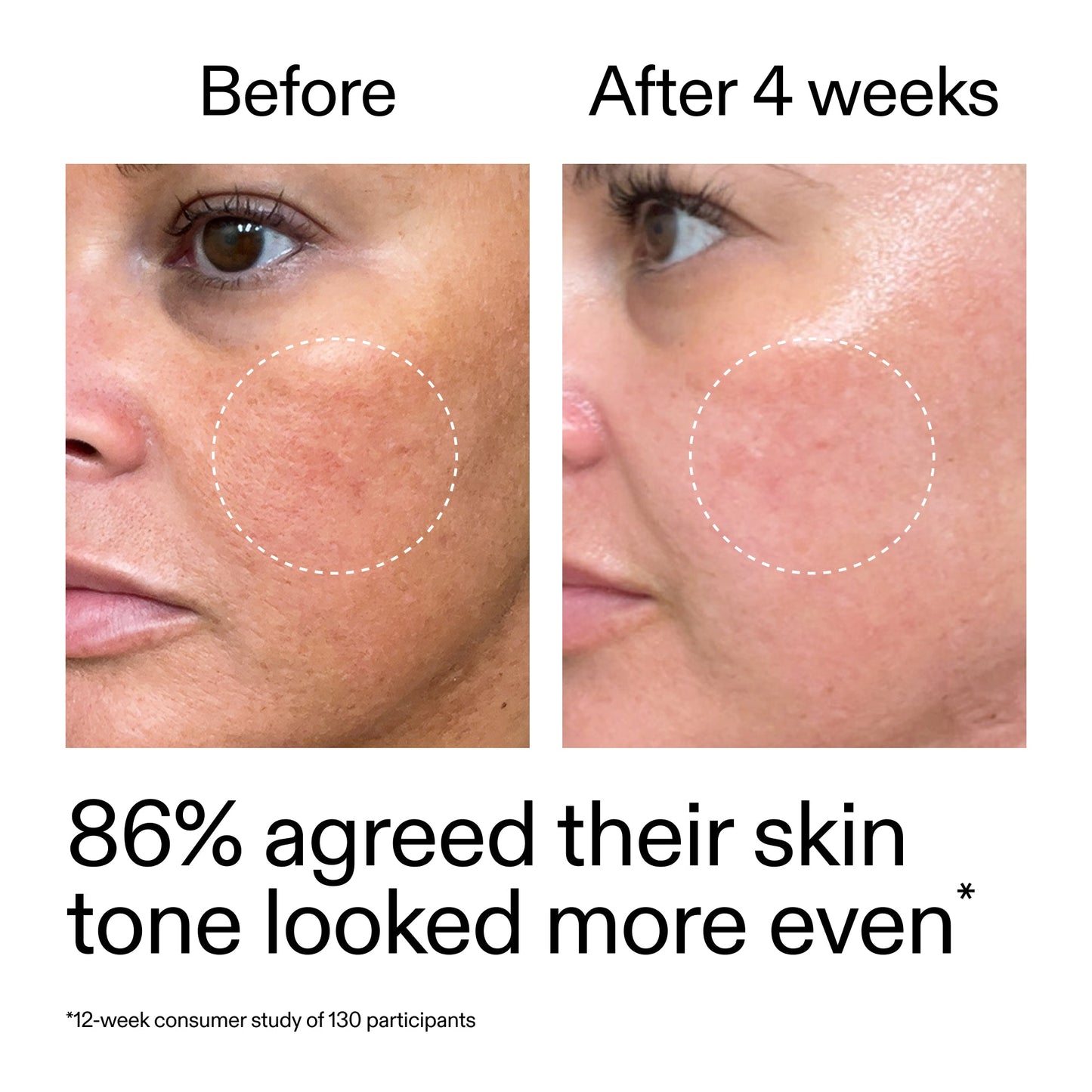 starter-retinol-serum-k9 StarterRetinol_BeforeAfter_Claim2_2000x2000_f5c9ecc0-8d76-429d-bef5-c3a61bcf5c09.jpg