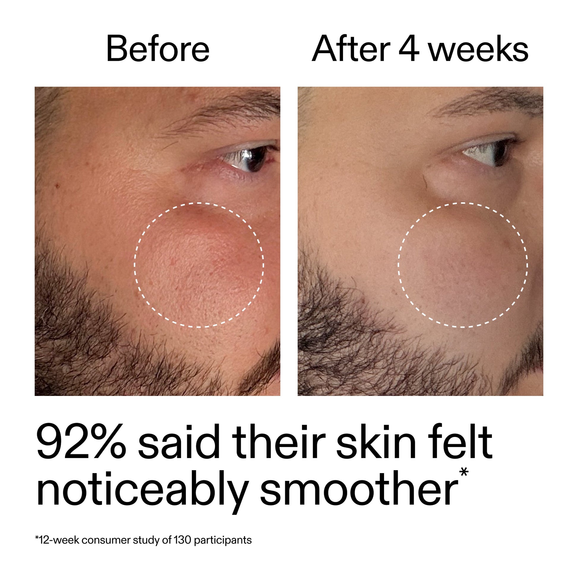 starter-retinol-serum-k9 StarterRetinol_BeforeAfter_Claim3_2000x2000_6ceab106-e0ee-4ed4-ba62-41bc39538038.jpg