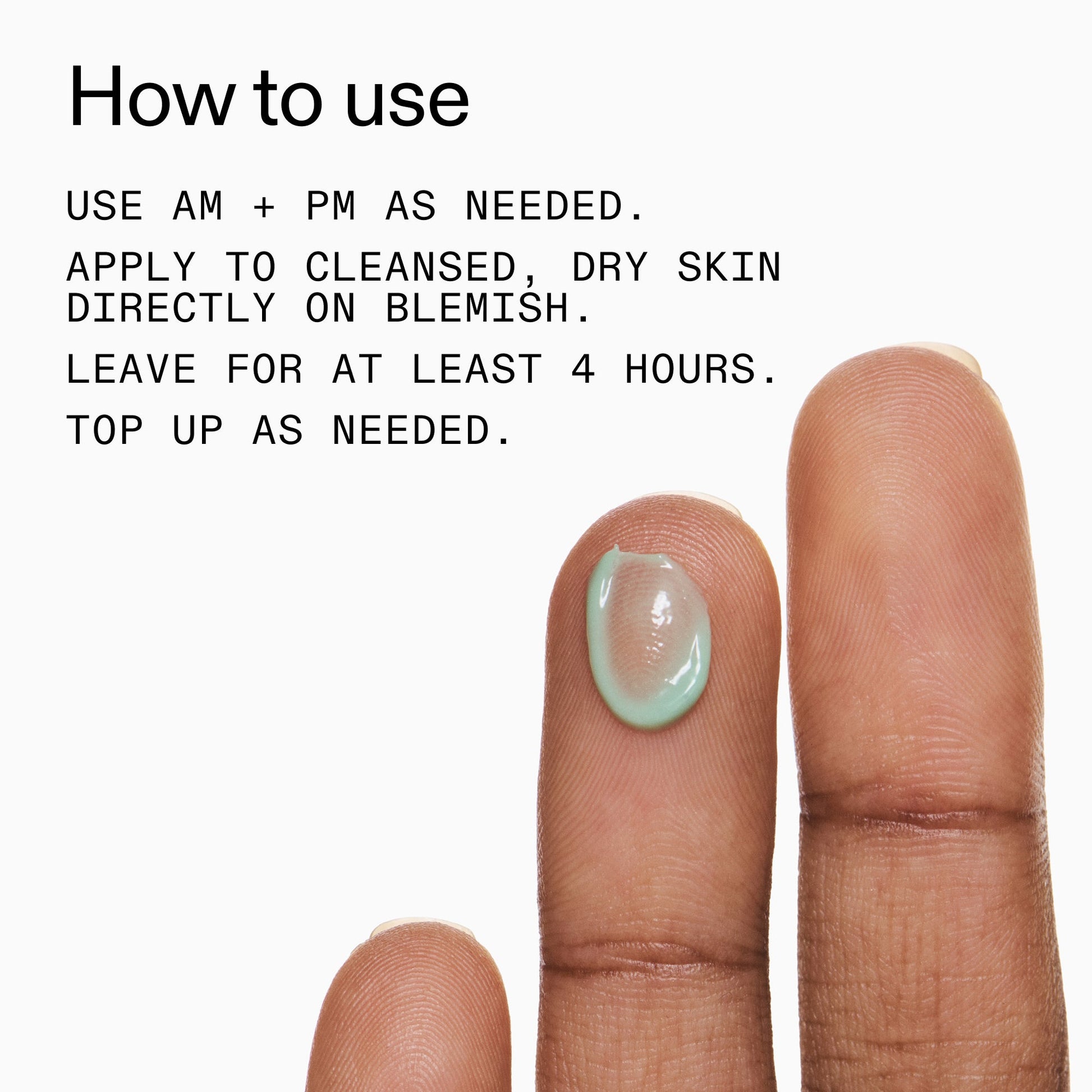 succinic-acid-acne-treatment-j6 Succinic_Acid_Treatment_How_to_Use_2000x2000_d57137d5-d7f1-427c-9a46-5fc00c19c542.jpg